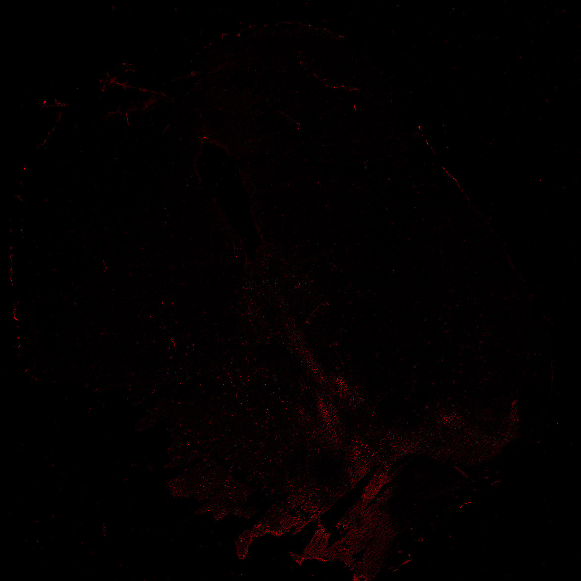 Human foetal midbrain